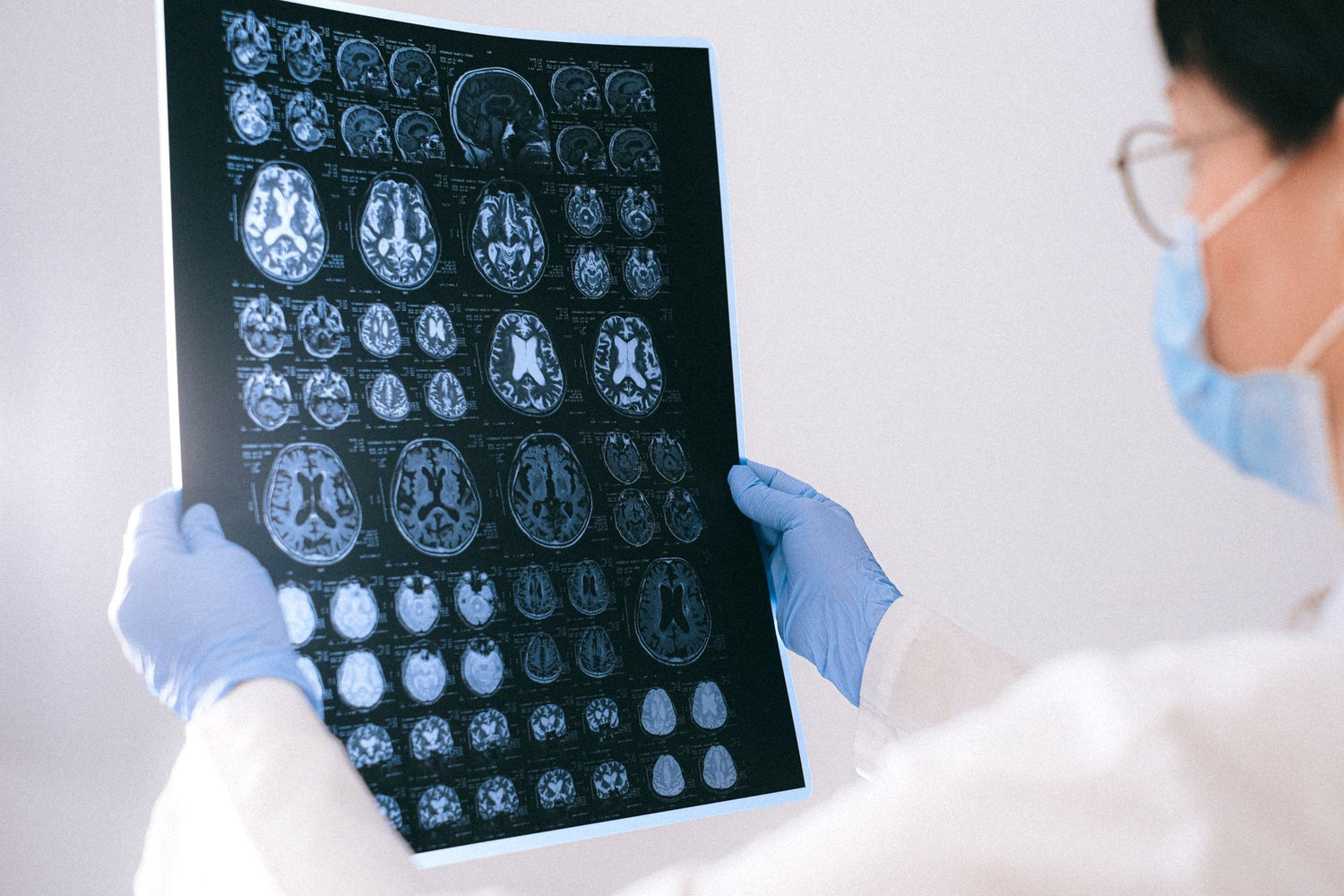 What Causes Severe Brain Fog? 9 Triggers Ranked by Onset Speed